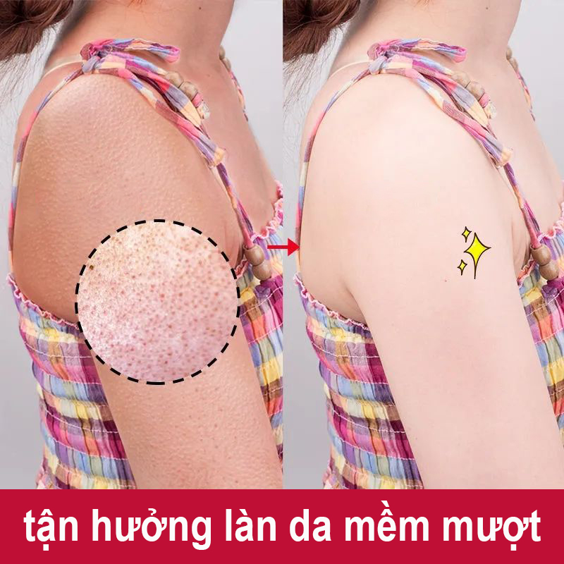 Kem Tẩy Da Chết Body Hiệu Quả Sau 5 Ngày Dùng Tẩy Tế Bào Chết Loại Bỏ Da Sạm Màu Cho Làn Da Trắng Hồng Tự Nhiên Thâm Hiệu Quả Làm Trắng Da