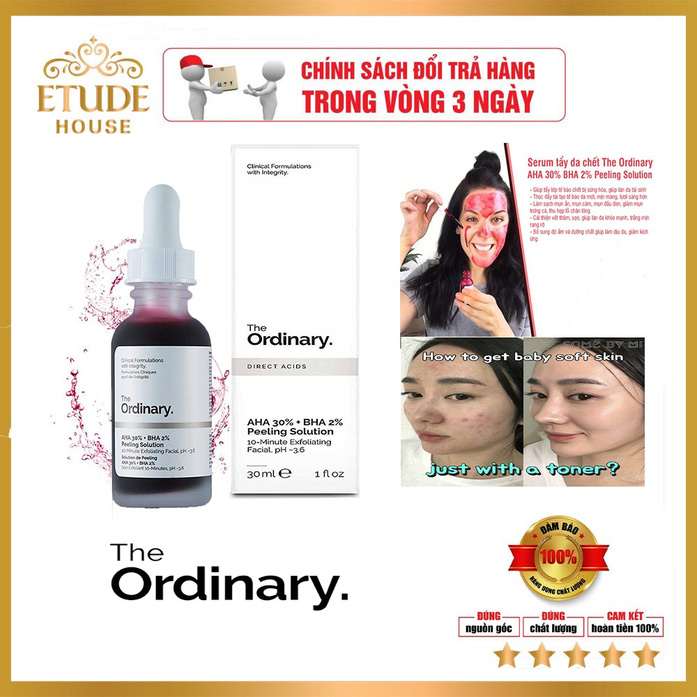 The Ordinary Aha 30% + Bha 2% - Giải Pháp Giúp Giảm Vết Thâm Da Sần Mụn Lỗ Chân Lông 30Ml