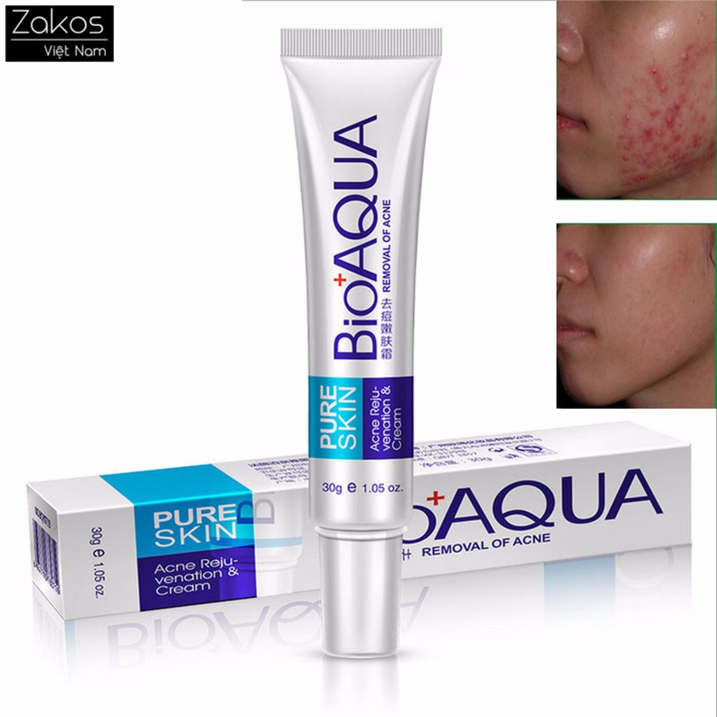 [HCM]Kem mụn Bioaqua Pure skin Nội địa Trung