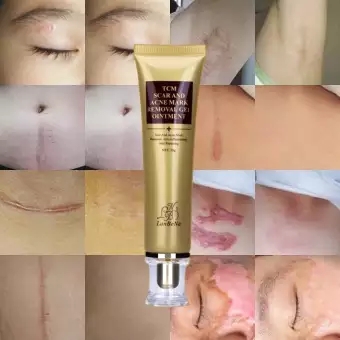 [HCM]LANBENA Kem Tri Mụn Original TCM Scar Removal Cream Pimple Stretch Marks Keloid Remover Skin Repair Face Cream Spots Effective Treatment 30g