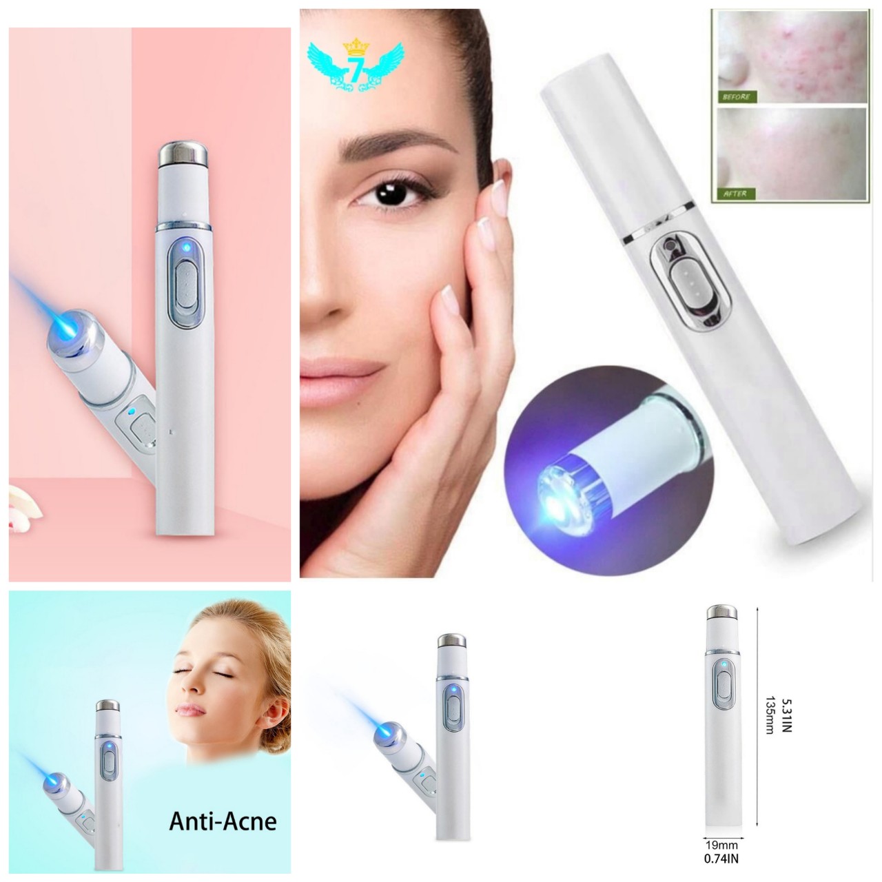 Bút Xóa Mụn Sẹo Nết Nhăn Bằng Laser Ánh Sáng Xanh Thần Kỳ Nhỏ Gọn Tiện Dụng Mẫu Mới Hàng Chất Lượng Cách Trị Mụn Tại Nhà An Toàn Cho Làn Da Mặt Không Để Lại Sẹo Vết Thâm