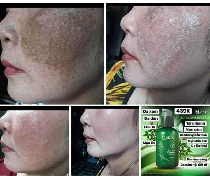 SÂM THAY DA MQ.SKIN CHÍNH HÃNG