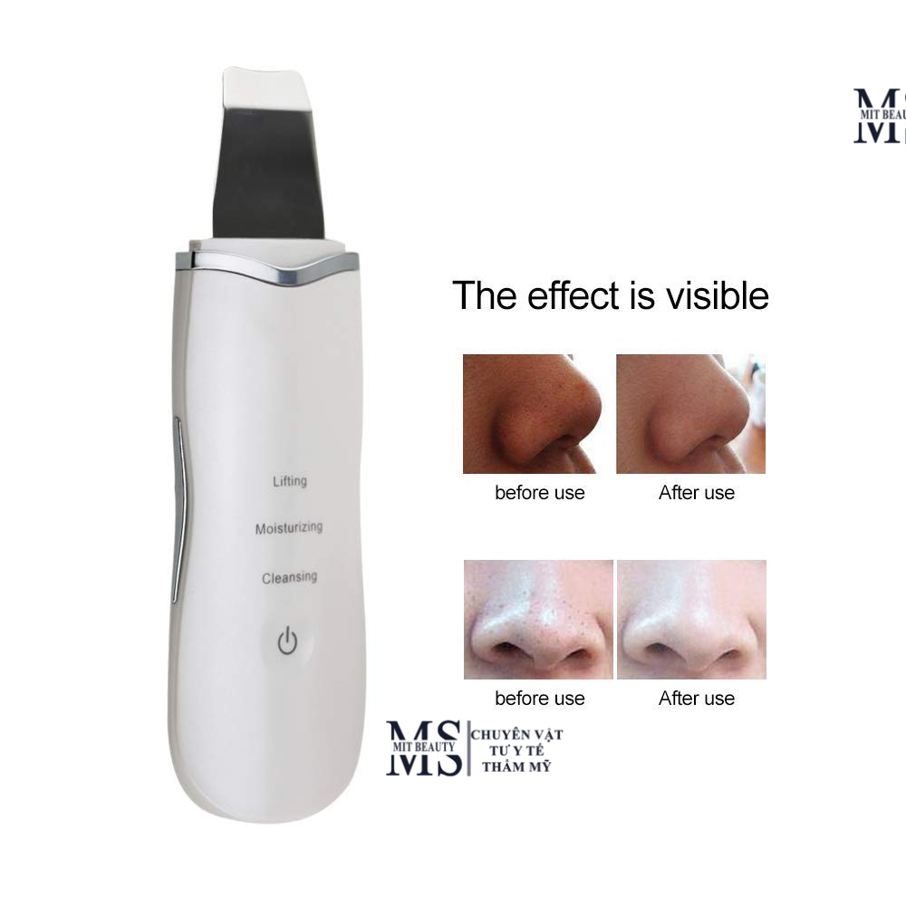 Máy cà da sủi da tại nhà ultrasonic shovel làm sạch sâu phiên bản mới Hàn Quốc