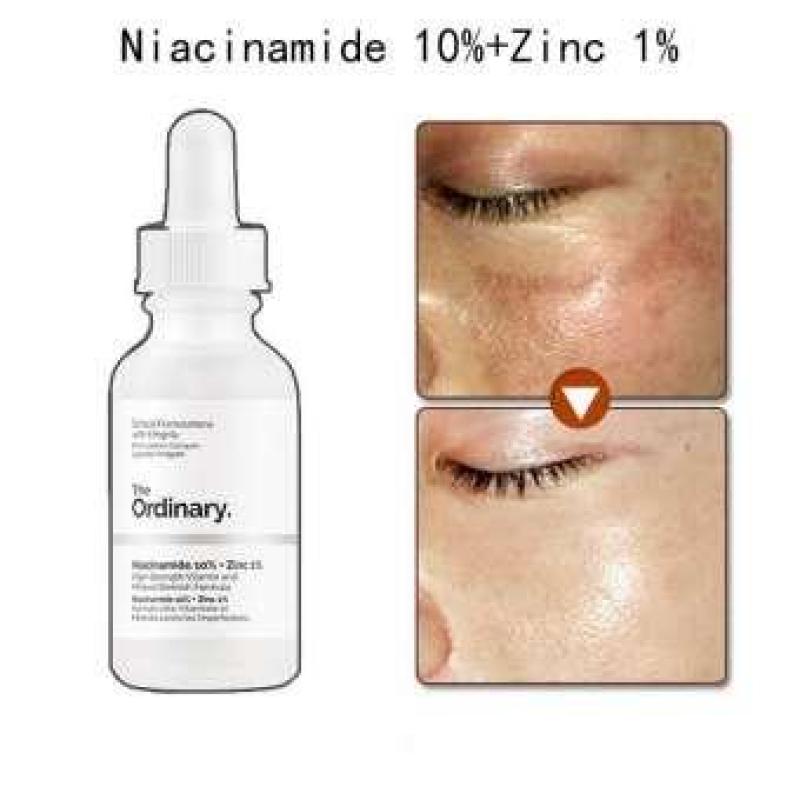 [Hcm]The Ordinary Niacinamide Nguyên Chất 10% + Kẽm 1% Tinh Chất Dưỡng Trắng Da Chống Thâm Nám 30Ml Serum Dầu Mặt Cân Bằng Làm Giảm Vết Thâm Cho Da Kem Dưỡng Ẩm Làm Trắng Da