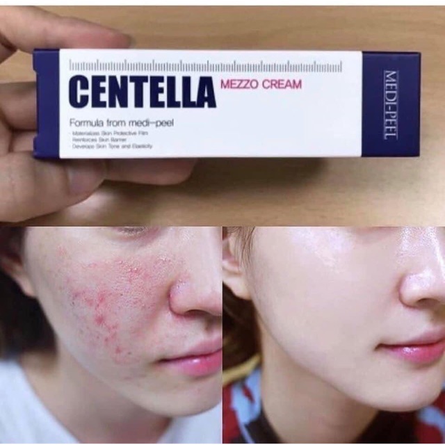 Kem Dưỡng Trị Mụn Medipeel Centella Mezzo Cream Cam Kết Hàng Đúng Mô Tả Chất Lượng Đảm Bảo An Toàn Cho Sức Khỏe Người Sử Dụng