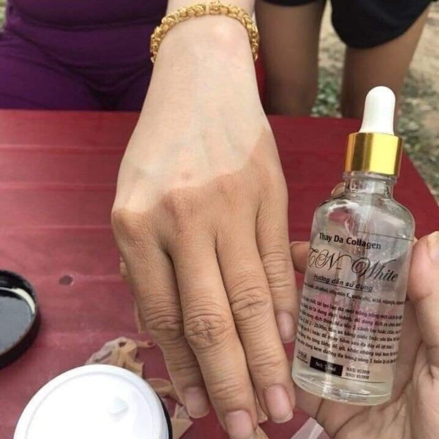 Kem Lột Nước NN- Thay Da Tay Chân Sinh Học 50ml