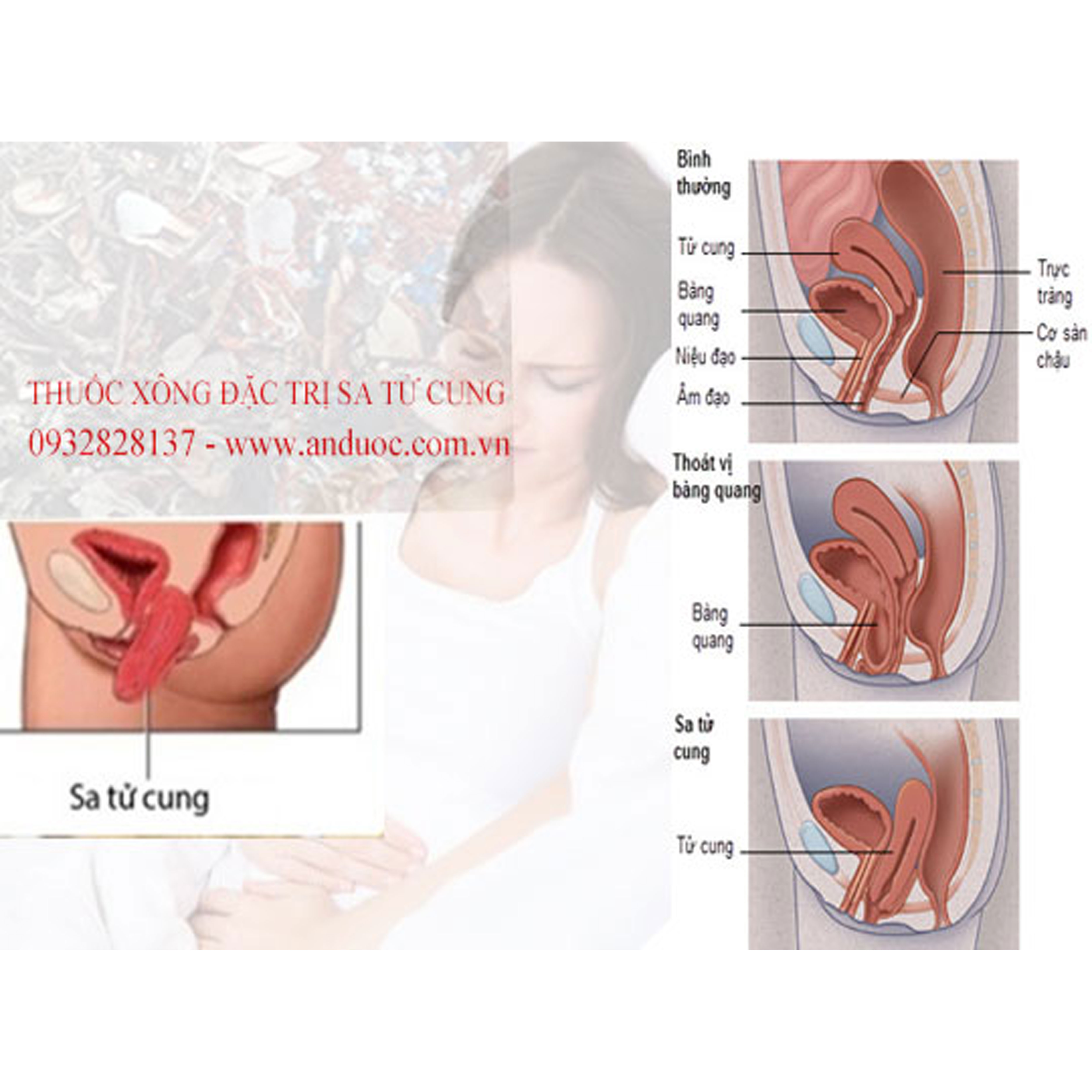 [HCM]ĐẦU CUA ĐINH XÔNG SAU SINH