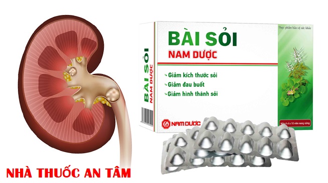 [HCM]Bài Sỏi Nam Dược