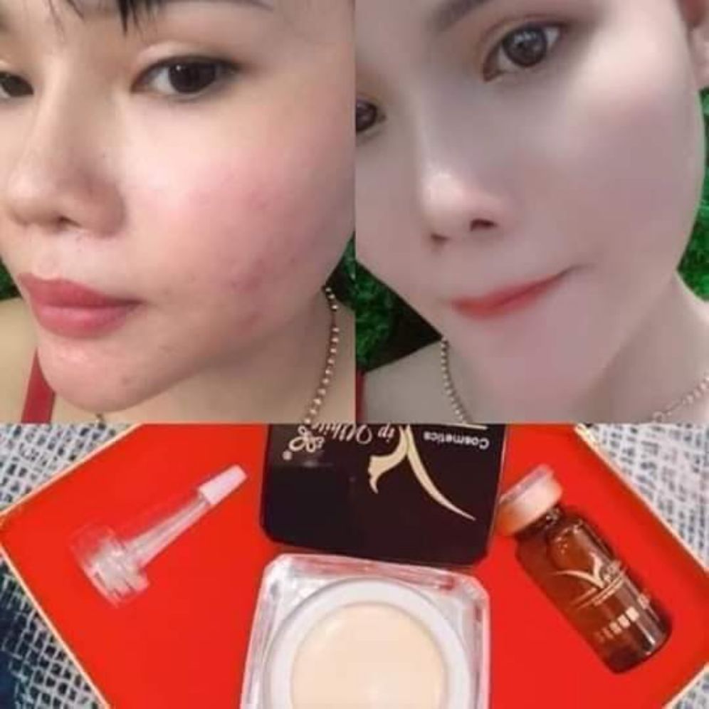 Bộ Kem Trắng Da Vip White Gồm 1 Kem Và 1 Serum