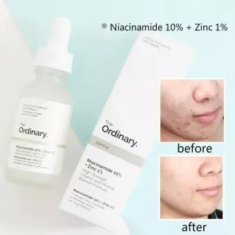 [HCM]The Ordinary Niacinamide 10% + Zinc 1% Face Serum Oil Balance Reduce Skin Blemishes Whitening Britening Moisturizer Essence Remove Acne 30ML
