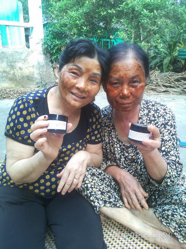 Cao Đắp Mặt Gia Truyền Bà Reo Hỗ Trợ Trị Mụn Trứng Cá Tàn Nhang Làm Mờ Sẹo Tái Tạo Collagen Làm Trắng Da Đẹp Da Nines Beauty Thành Phần Hoa Hồng Xả Mật Ong Và Các Thảo Dược Quý Khác.