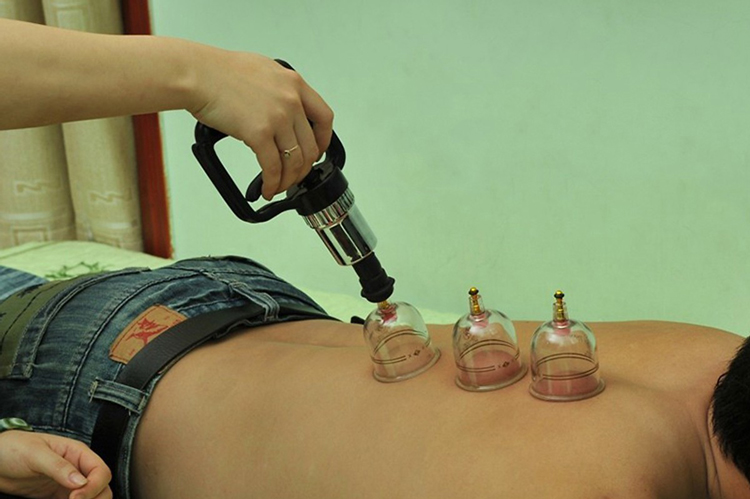 GIÁC HƠI KHÔNG DÙNG LỬA DUY THÀNH
