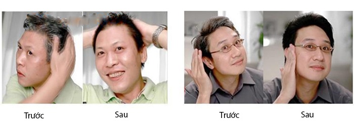 luoc-nhuom-toc-thong-minh-5