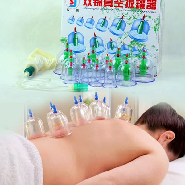 Bán sỉ bộ giác hơi không dùng lửa 12 ống